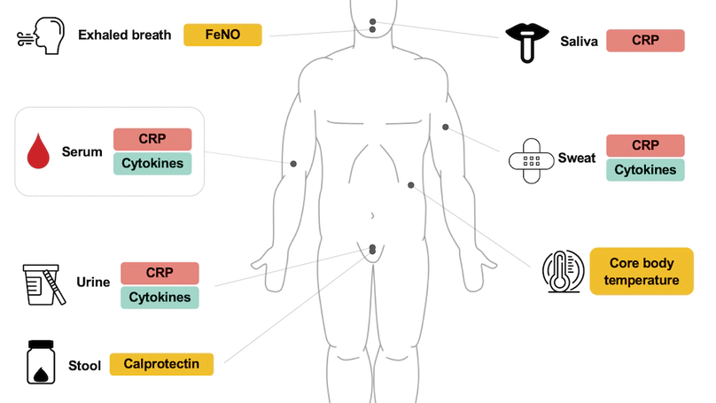 Non-invasive, Multi-modal Inflammatory Biomarker Discovery for Systemic Inflammation (NOVA Study): A Feasibility Study Protocol (Under Review)